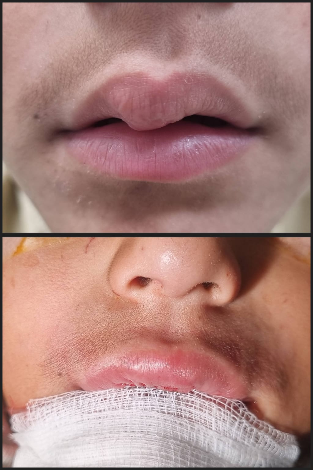 Before & After 59